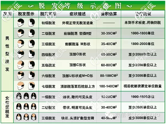 脫發(fā)等級的示意圖