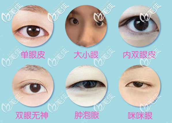 韓美無痕雙眼皮能解決哪些眼部問題 韓美無痕雙眼皮能解決哪些眼部問題
