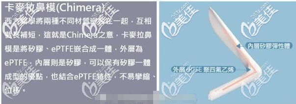 卡麥拉隆鼻假體 卡麥拉隆鼻假體