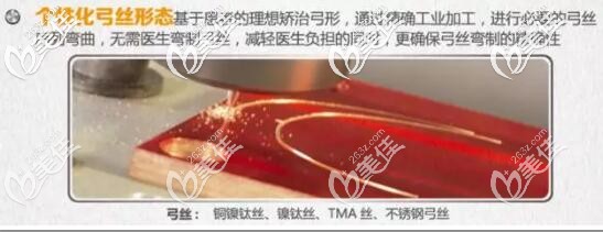 insignia精準(zhǔn)正畸個(gè)性化弓絲 insignia精準(zhǔn)正畸個(gè)性化弓絲