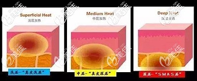 熱拉提的主要作用