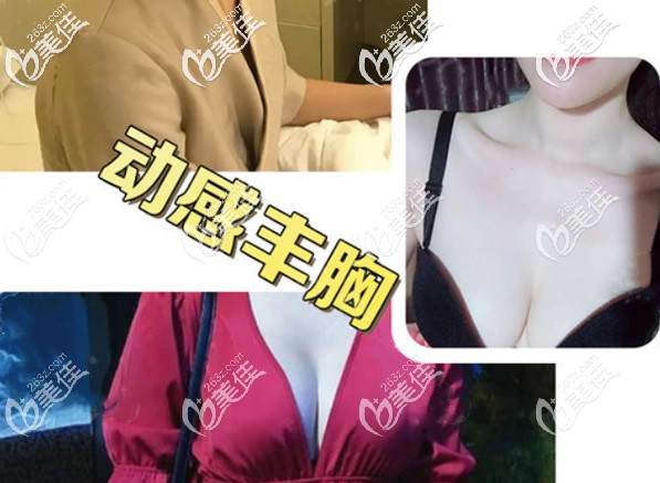 內(nèi)窺鏡雙平面隆胸效果案例