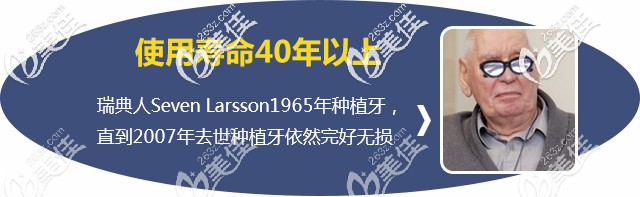 種植體的使用壽命 種植體的使用壽命