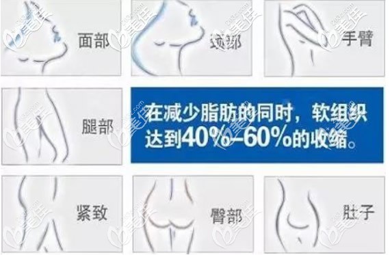 黃金微雕適合的部位 黃金微雕適合的部位