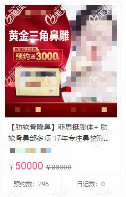 菲思挺膨體隆鼻5萬多的價格 菲思挺膨體隆鼻5萬多的價格