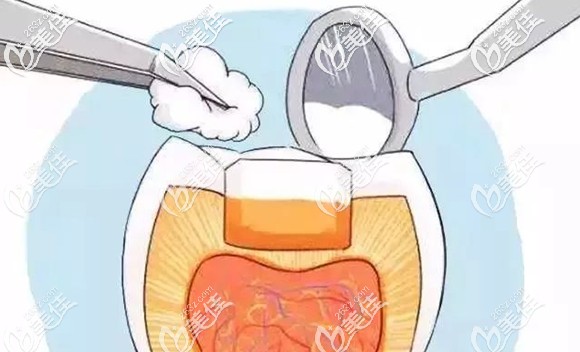 門牙用復(fù)合樹脂美學(xué)修復(fù) 門牙用復(fù)合樹脂美學(xué)修復(fù)