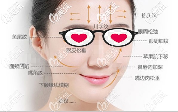 面部哪些部位適合做熱拉提