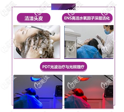 防脫育發(fā)治療脫發(fā)方案