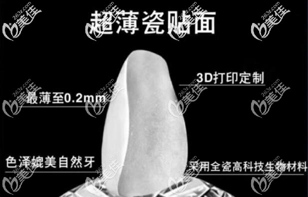 超薄全瓷牙齒貼面不磨牙 超薄全瓷牙齒貼面不磨牙