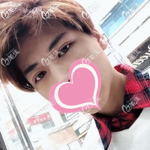 埋線重瞼6個月眼皮松弛還不對稱，是不是只能做全切雙眼皮修復(fù)不能恢復(fù)原來的樣子了