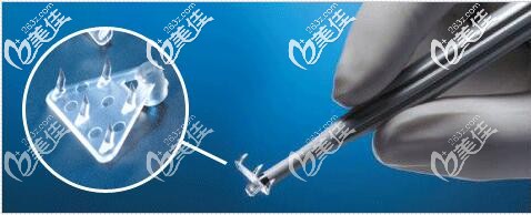 安多肽植入的線材 安多肽植入的線材