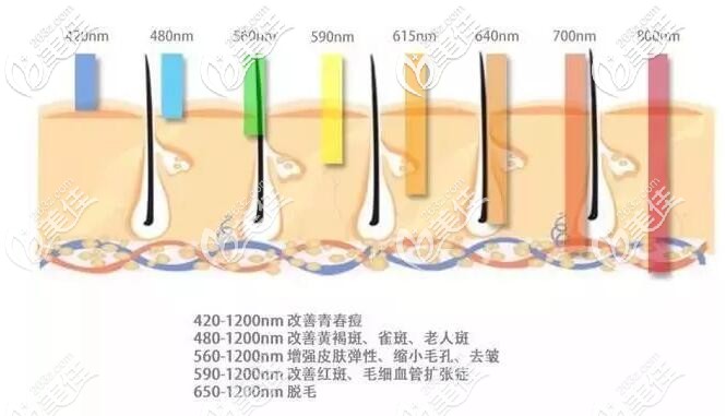 光子嫩膚的不同作用 光子嫩膚的不同作用