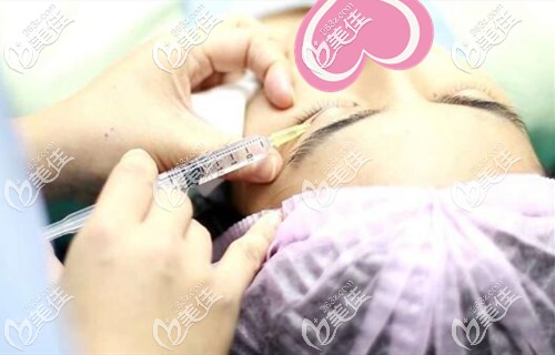 雙眼皮手術(shù)注射麻藥