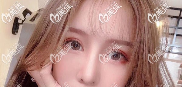 這么美麗惑人的大眼睛，你不想擁有嗎