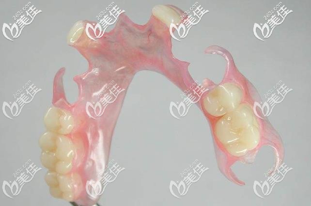 活動(dòng)義齒外觀圖 活動(dòng)義齒外觀圖