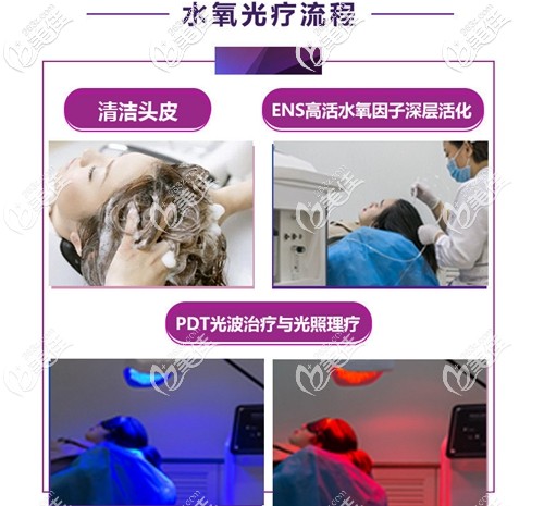 水氧光療防脫育發(fā)流程 水氧光療防脫育發(fā)流程