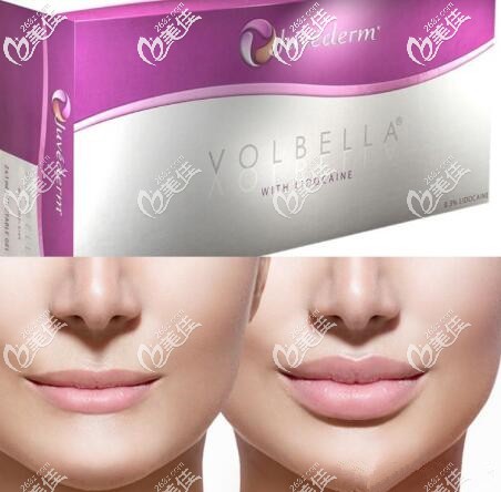 喬雅登VOLBELLA豐唇效果 喬雅登VOLBELLA豐唇效果