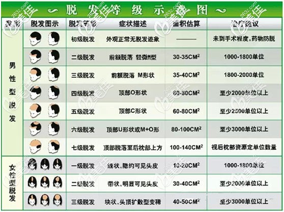 脫發(fā)等級示意圖 脫發(fā)等級示意圖