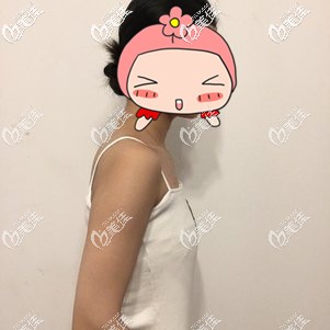 隆胸手術(shù)前自己的平胸 隆胸手術(shù)前自己的平胸