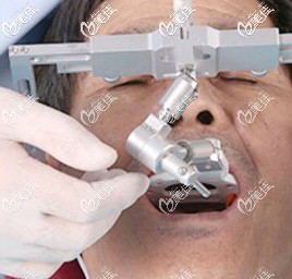 使用電子面弓測量口腔數(shù)據(jù) 使用電子面弓測量口腔數(shù)據(jù)