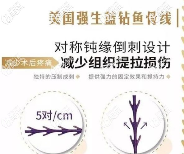 美國強(qiáng)生藍(lán)鉆魚骨線優(yōu)勢(shì) 美國強(qiáng)生藍(lán)鉆魚骨線優(yōu)勢(shì)