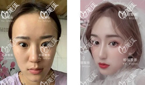 北京柏麗李勁良做鼻子怎么樣