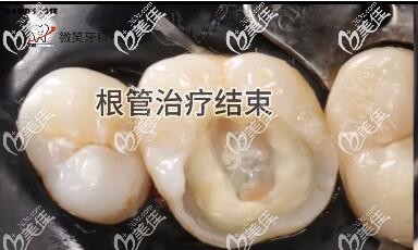 ?？谖⑿ρ揽魄扼w補牙真人案例