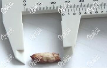 取出的骨粉圖片