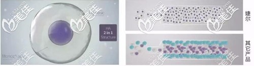 婕爾玻尿酸的優(yōu)勢 婕爾玻尿酸的優(yōu)勢