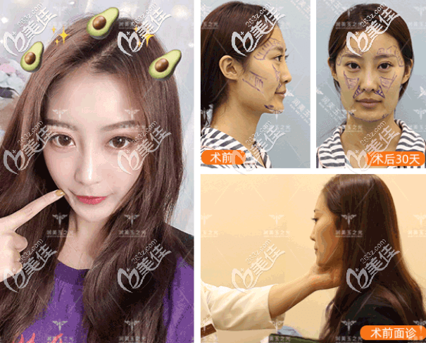 北京潤(rùn)美玉之光王明利 北京潤(rùn)美玉之光王明利