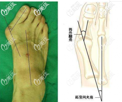 20200509_1589006280733427.png image.png