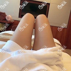 到泰國TARA CLINIC整形做威塑吸脂大腿手術(shù)才花了3萬多，在國內(nèi)都要5萬多呢