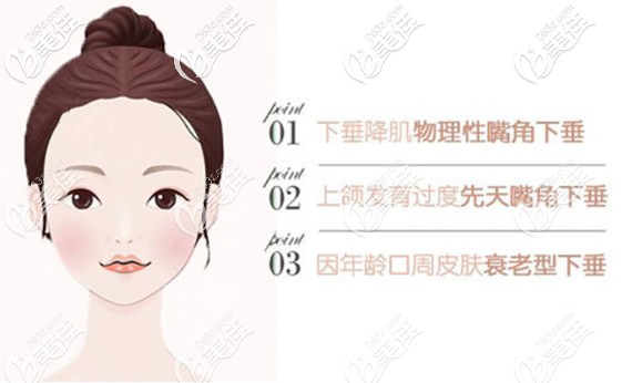 嘴角下垂形成的原因