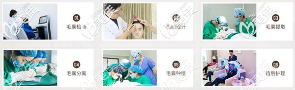 沈陽(yáng)華美植發(fā)流程