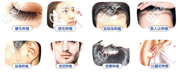 沈陽(yáng)華美植發(fā)研究院毛發(fā)移植服務(wù)