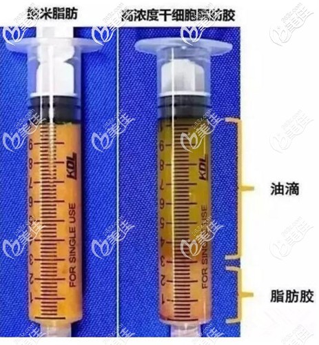 什么是脂肪膠 什么是脂肪膠