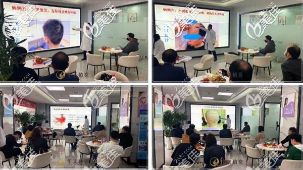 沈陽華美竇剛院長分享植發(fā)案例 沈陽華美竇剛院長分享植發(fā)案例