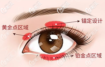 2汕頭ido整形醫(yī)院張賢期醫(yī)生雙眼皮 2汕頭ido整形醫(yī)院張賢期醫(yī)生雙眼皮