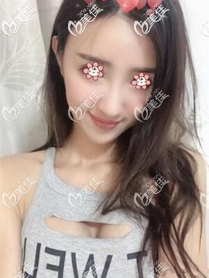 這醫(yī)院在泰國隆胸還真可以