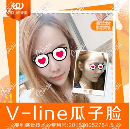 杭州華山連天美醫(yī)院高俊明院長輪廓三件套效果