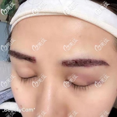 成都恒博毛發(fā)科植眉毛即刻效果 成都恒博毛發(fā)科植眉毛即刻效果