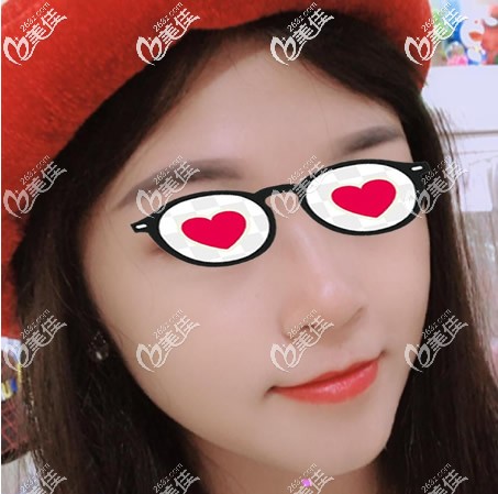 千萬別做面部吸脂!我臉部抽脂特別后悔,因為嘴角旁邊下垂的兩坨肉不見了,哈哈!