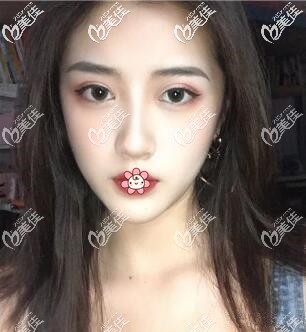 兩個月已經(jīng)超好看了 兩個月已經(jīng)超好看了