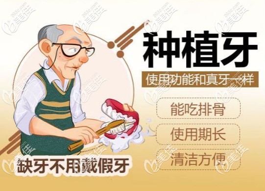 全口種植牙的好處 全口種植牙的好處