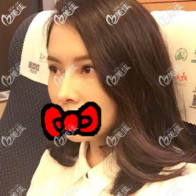 術(shù)后一周手術(shù)部位還有點腫