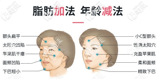 廣州佳人整形董東善醫(yī)生擅長脂肪填充 廣州佳人整形董東善醫(yī)生擅長脂肪填充