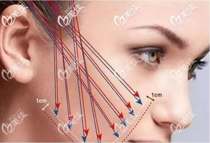 埋線(xiàn)的層次決定位置