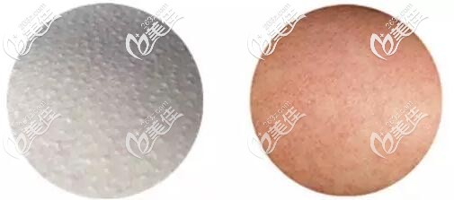 雞皮膚圖片 雞皮膚圖片