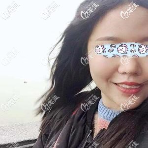 好多人都說看完我假體墊下巴12天恢復(fù)圖以為是失敗，誰知道半年后再看婆婆嘴已經(jīng)恢復(fù)自然