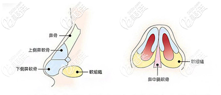 深圳美顏整形醫(yī)院林仕錦隆鼻優(yōu)勢(shì) 深圳美顏整形醫(yī)院林仕錦隆鼻優(yōu)勢(shì)